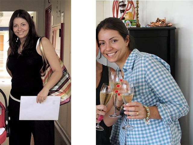 antes e depois