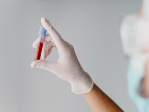 País registra aumento de 168% nos casos de HIV entre os jovens