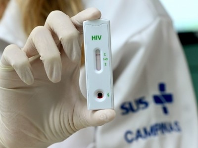 Campinas registra reduções de infecções por HIV e mortes provocadas pela aids