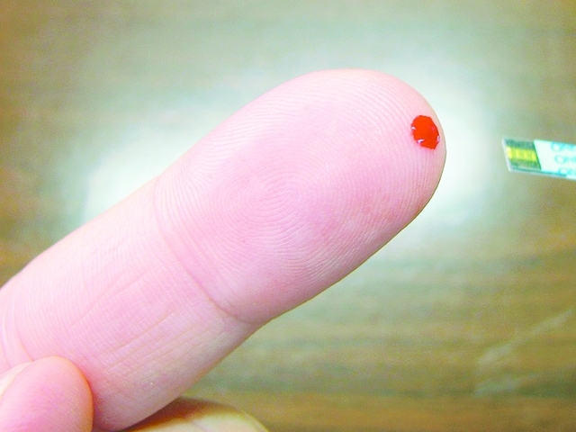 A doença provoca elevação da glicose no sangue