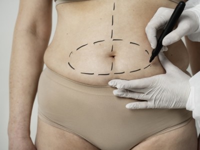 Cirurgia plástica exige preparo e avaliação individual antes do bisturi, alertam especialistas