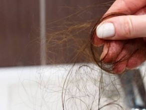 Cabelo afinando não é necessariamente calvície: como identificar os primeiros sinais de rarefação capilar